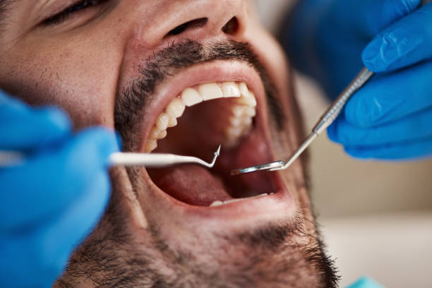 Full Mouth Reconstruction in Lafayette, CA